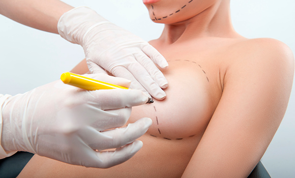 Augmentation Mammaplasty / Breast Implats