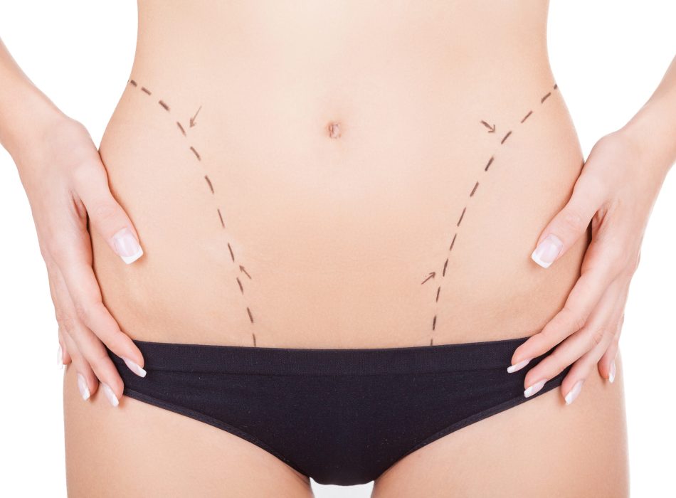 Ready for hips improvement. Cropped image of woman in panties and sketches on her abdomen holding hands on hip while standing isolated on white background