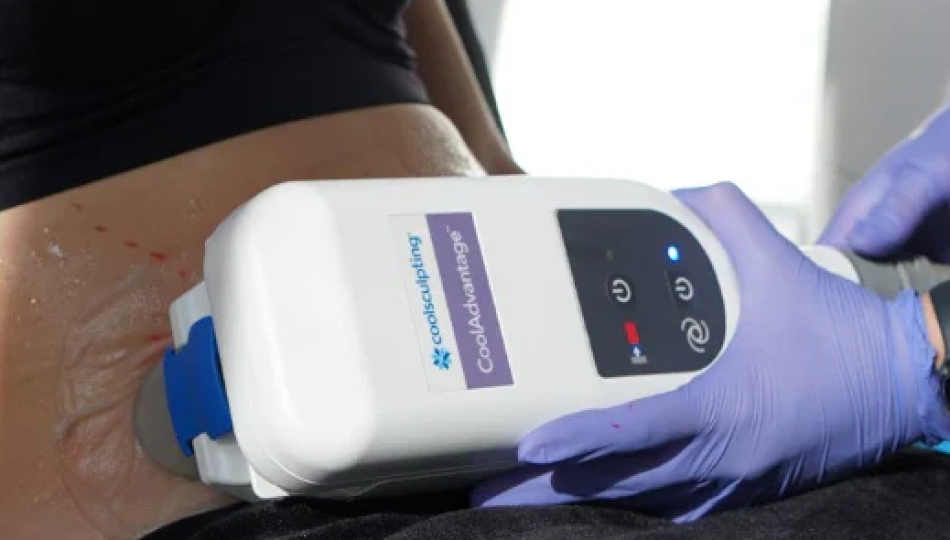 CoolSculpting